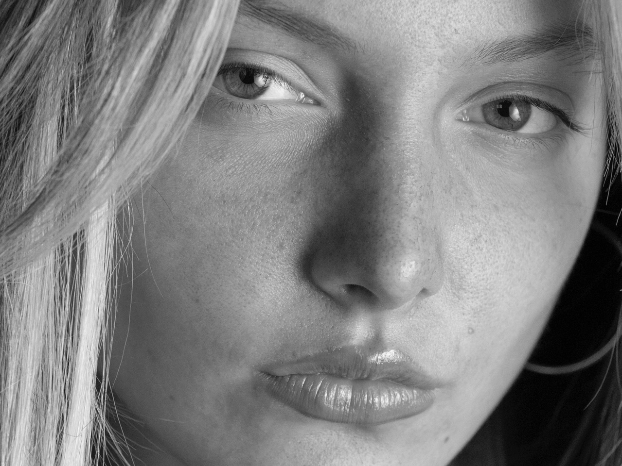 "Chin lift as part of Dr. Kevin Tehrani’s signature mommy makeover